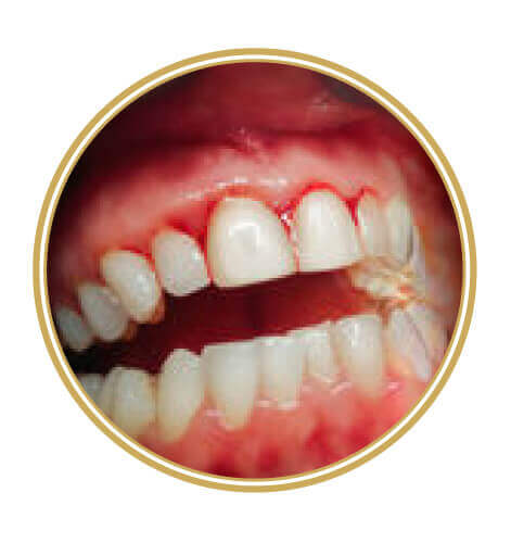 Artisdental – parodontologija Artisdental - parodontologija