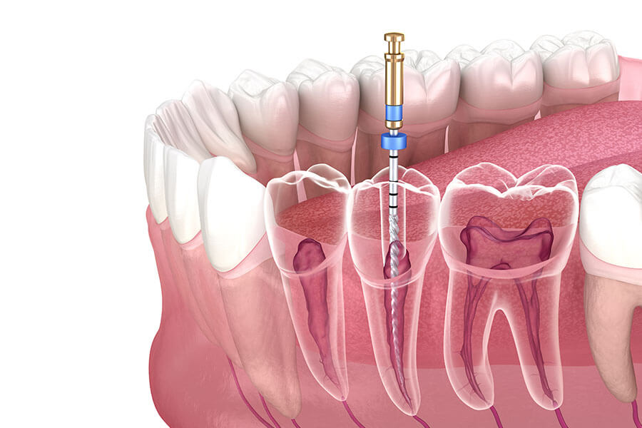 Endodontija