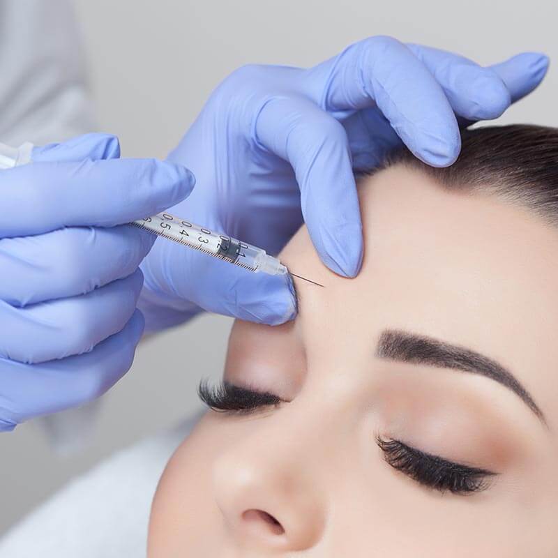Glajenje obraznih gub z Botoxom Glajenje obraznih gub z Botoxom